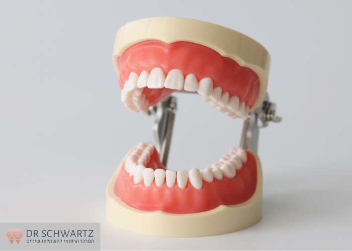 תמונה ראשית - ניתוח במפרק הלסת TMJ - מרפאת השיניים דר שוורץ בנתניה