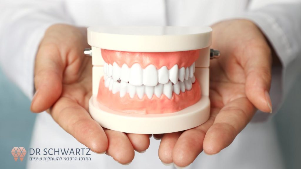 ציפוי שיניים למינייט - תמונה ראשית - ד״ר שוורץ
