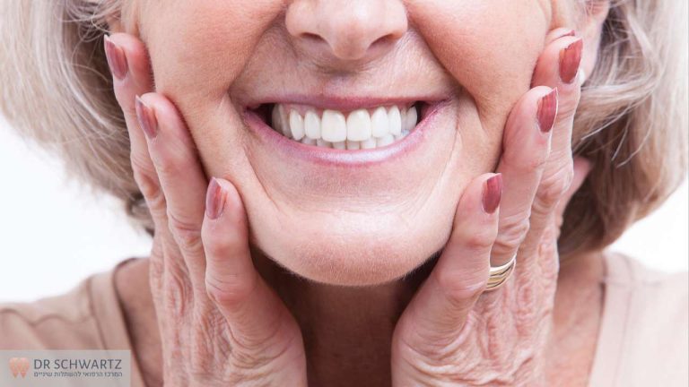 האם אפשר לבצע טיפול הלבנה עבור שיניים תותבות (שתלים) ד״ר שוורץ